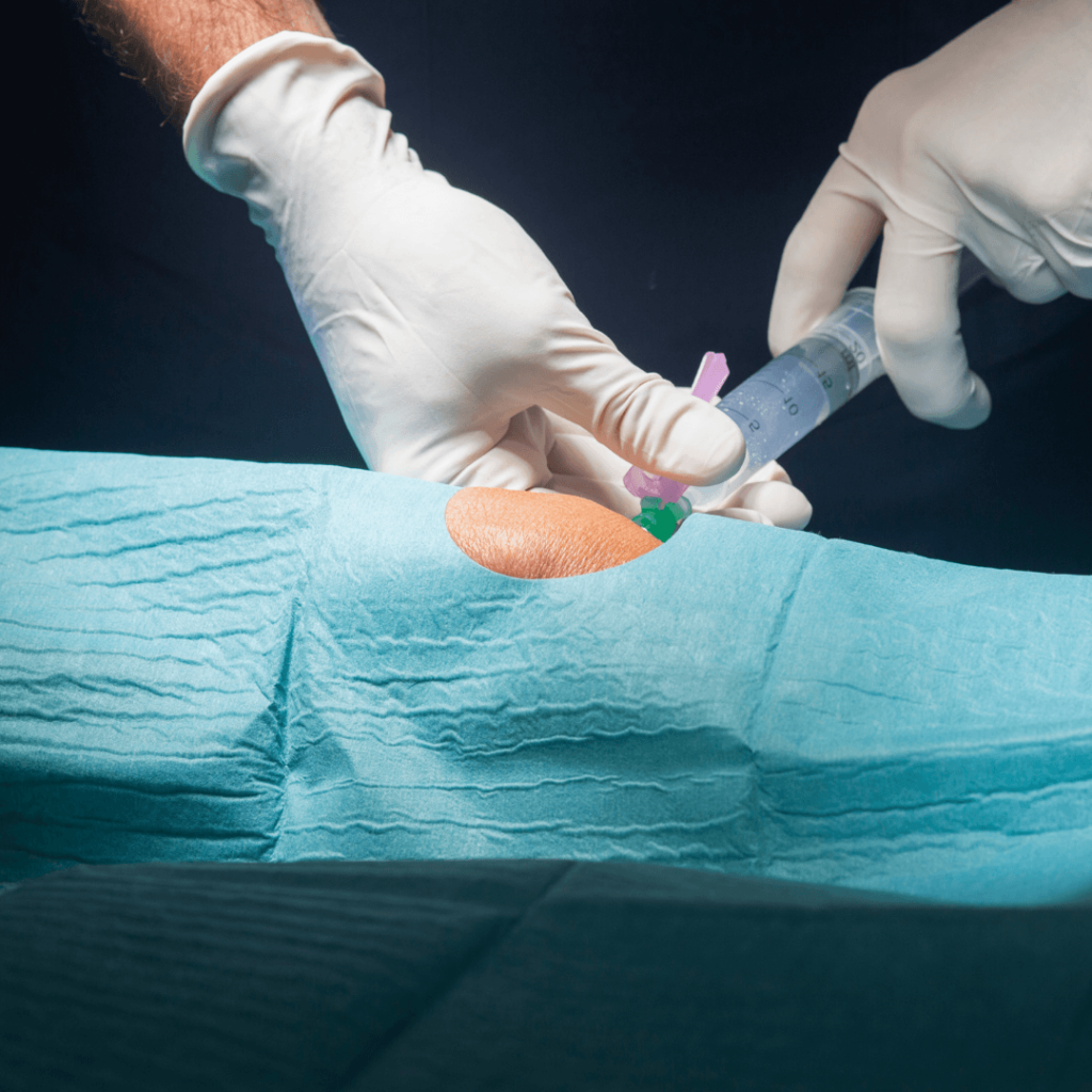 O uso da viscossuplementação para o tratamento da Artrose